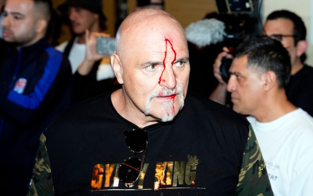 John Fury Bloodied in Altercation at Usyk-Fury Media Day